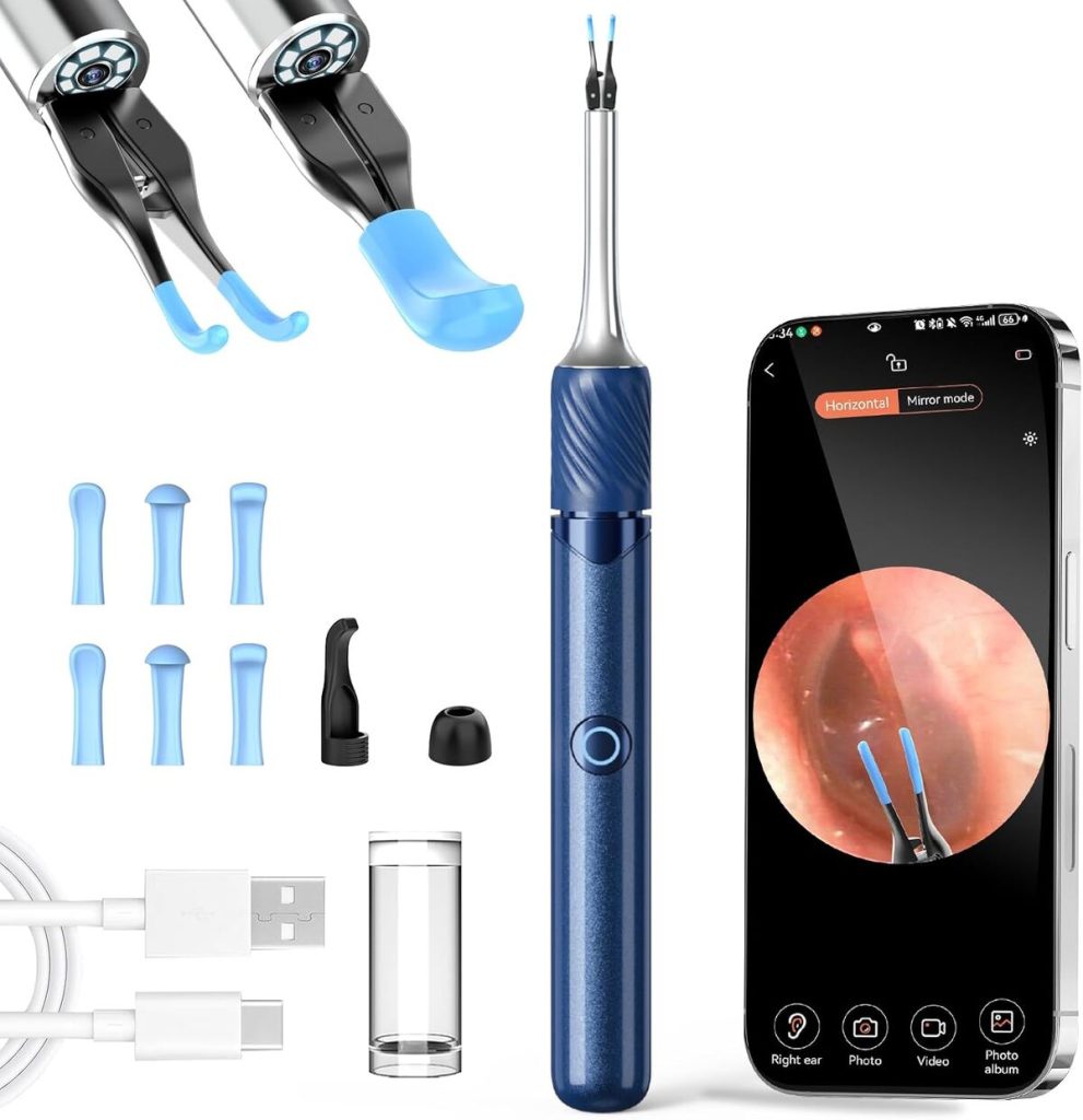 Test : otoscope Vitcoco 1080p, caméra oreille polyvalente